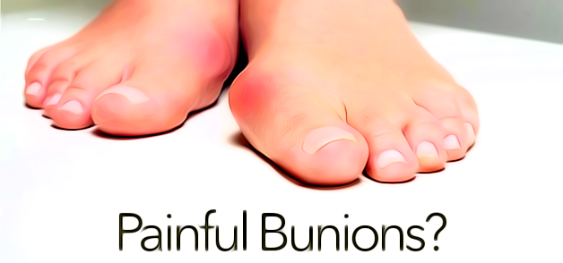 Painful Bunions?