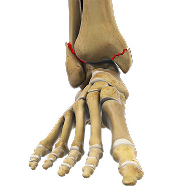Ankle on sale bone increase