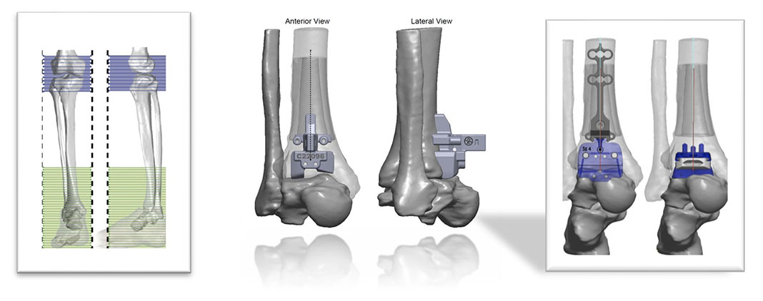case2 a