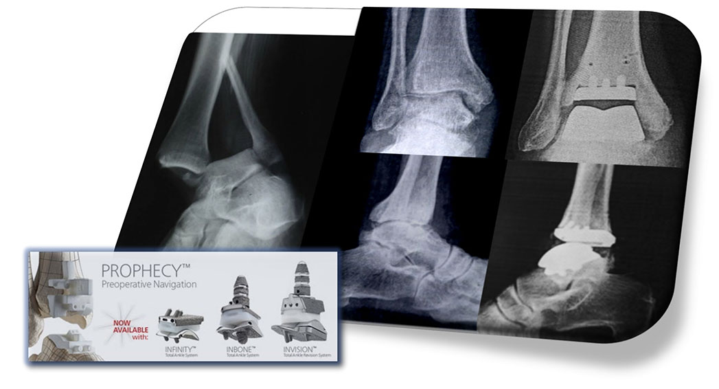 case2 b