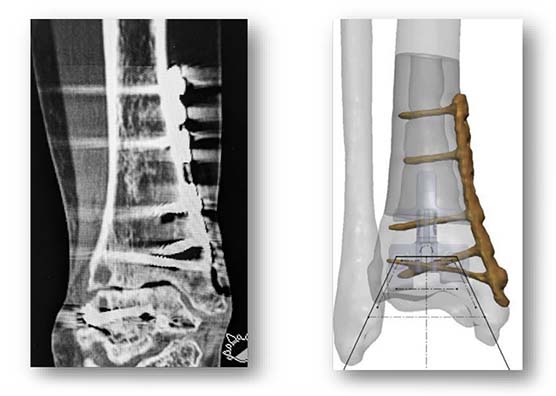 ct scan 3d