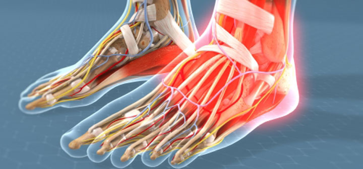 Arthritis of the Foot/Ankle