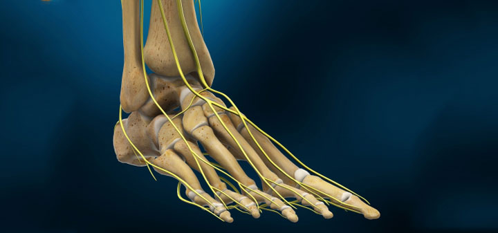 Peripheral Nerve Disorders