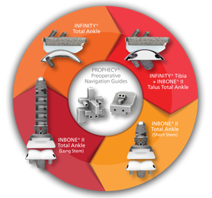 Wright Medical Total Ankle Systems